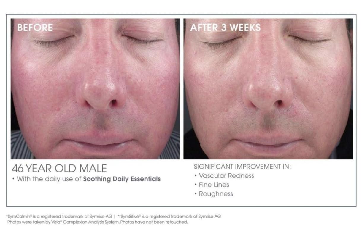 Glowbiotics Calming Restorative Treatment: Hydrating Face Serum for Redness Relief & Sensitive Skin | Soothes Irritated Skin with Probiotics & Hyaluronic Acid